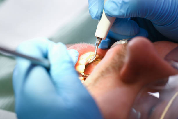 Best Emergency Dentist for Special Needs Patients in Rossville, IN