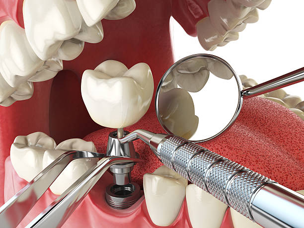 Best Pediatric Emergency Dentist in Rossville, IN
